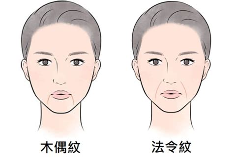 法令紋木偶紋